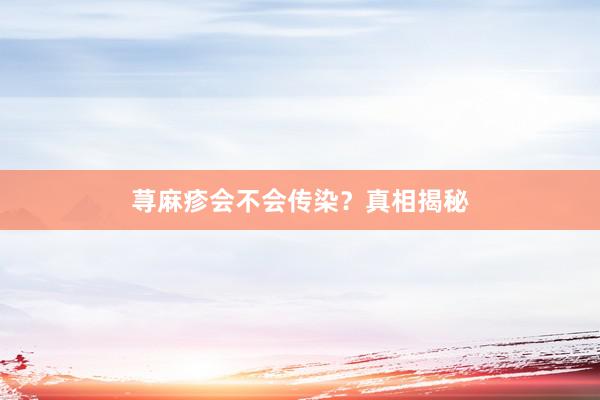 荨麻疹会不会传染？真相揭秘